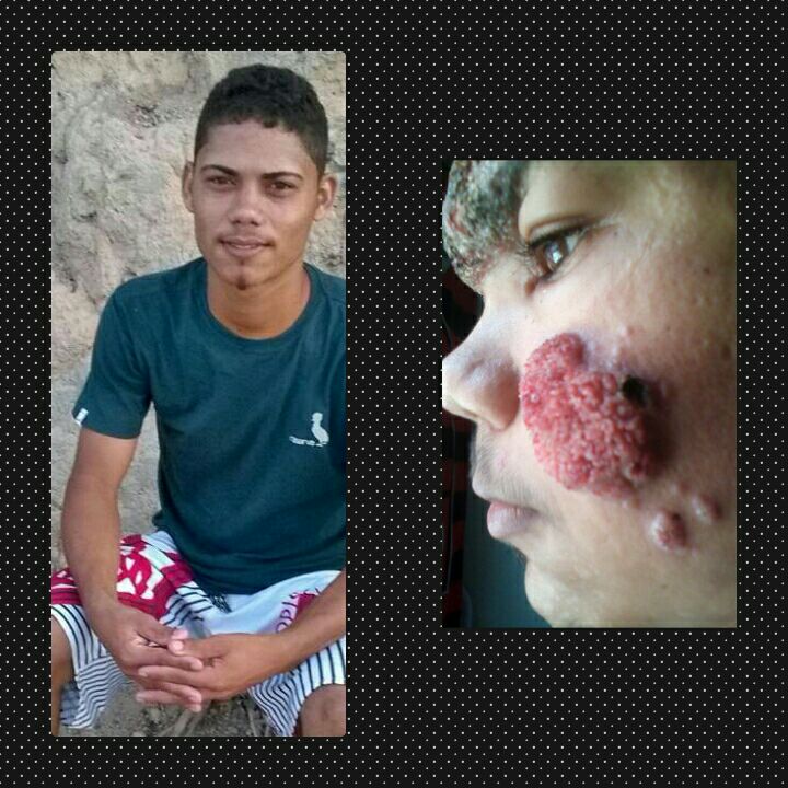 Jovem faz apelo por conta de doença no rosto 5